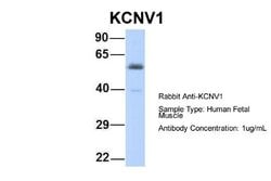 Kv8.1 Rabbit anti-Human, Polyclonal, Novus Biologicals 0.1 mL | Buy Online | Novus Biologicals | Fisher Scientific